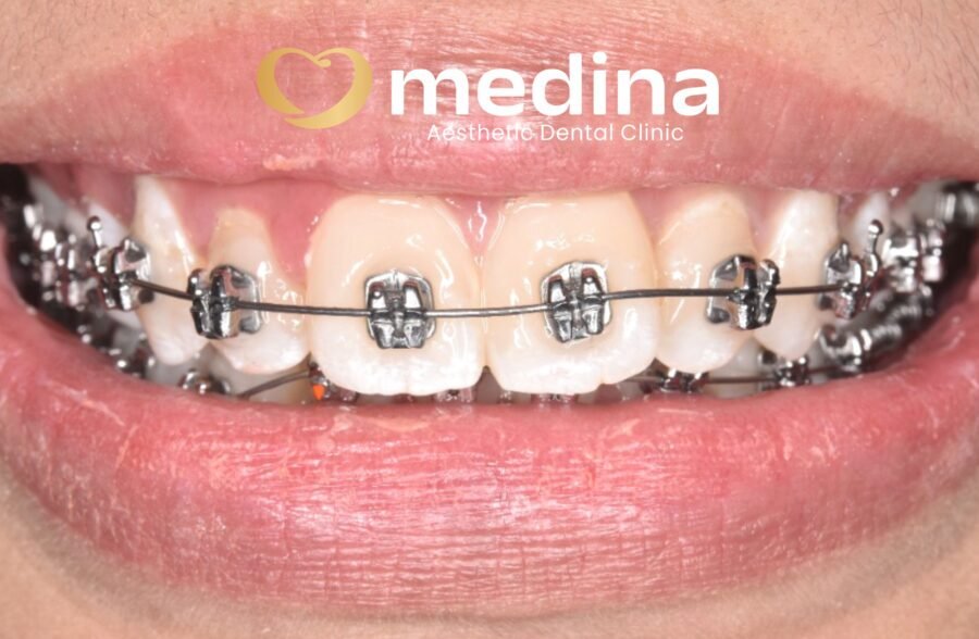 Behel klinik gigi jepara medina