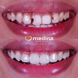 TAMBAL GIGI JEPARA MEDINA I DOKTER GIGI JEPARA