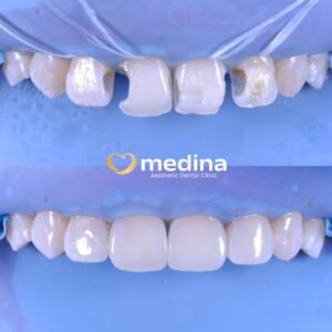 TAMBAL GIGI JEPARA MEDINA I DOKTER GIGI JEPARA