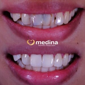 TAMBAL GIGI JEPARA MEDINA I DOKTER GIGI JEPARA