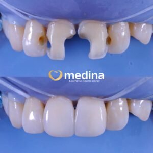 TAMBAL GIGI JEPARA MEDINA I DOKTER GIGI JEPARA