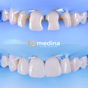 TAMBAL GIGI JEPARA MEDINA I DOKTER GIGI JEPARA