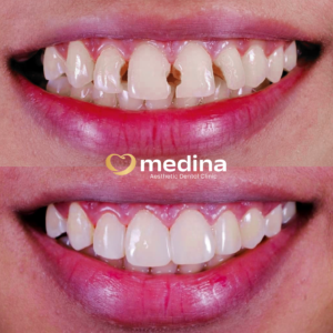 TAMBAL GIGI JEPARA MEDINA I DOKTER GIGI JEPARA