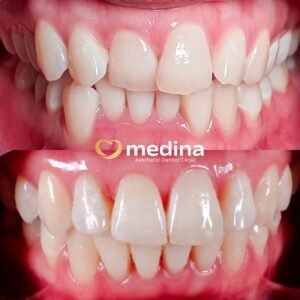 BEHEL DOKTER GIGI JEPARA MEDINA