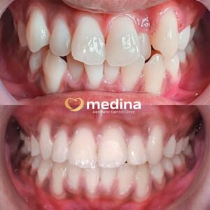 BEHEL DOKTER GIGI JEPARA MEDINA