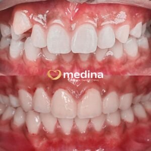 BEHEL DOKTER GIGI JEPARA MEDINA