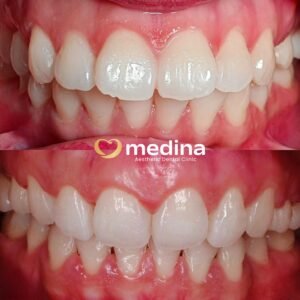 BEHEL DOKTER GIGI JEPARA MEDINA