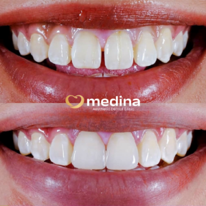 DOKTER GIGI JEPARA MEDINA TAMBAL GIGI