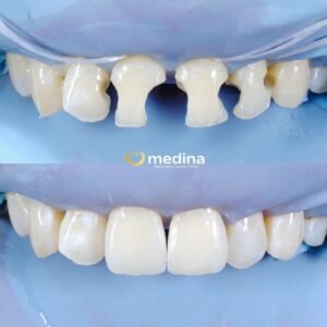 TAMBAL DOKTER GIGI JEPARA MEDINA