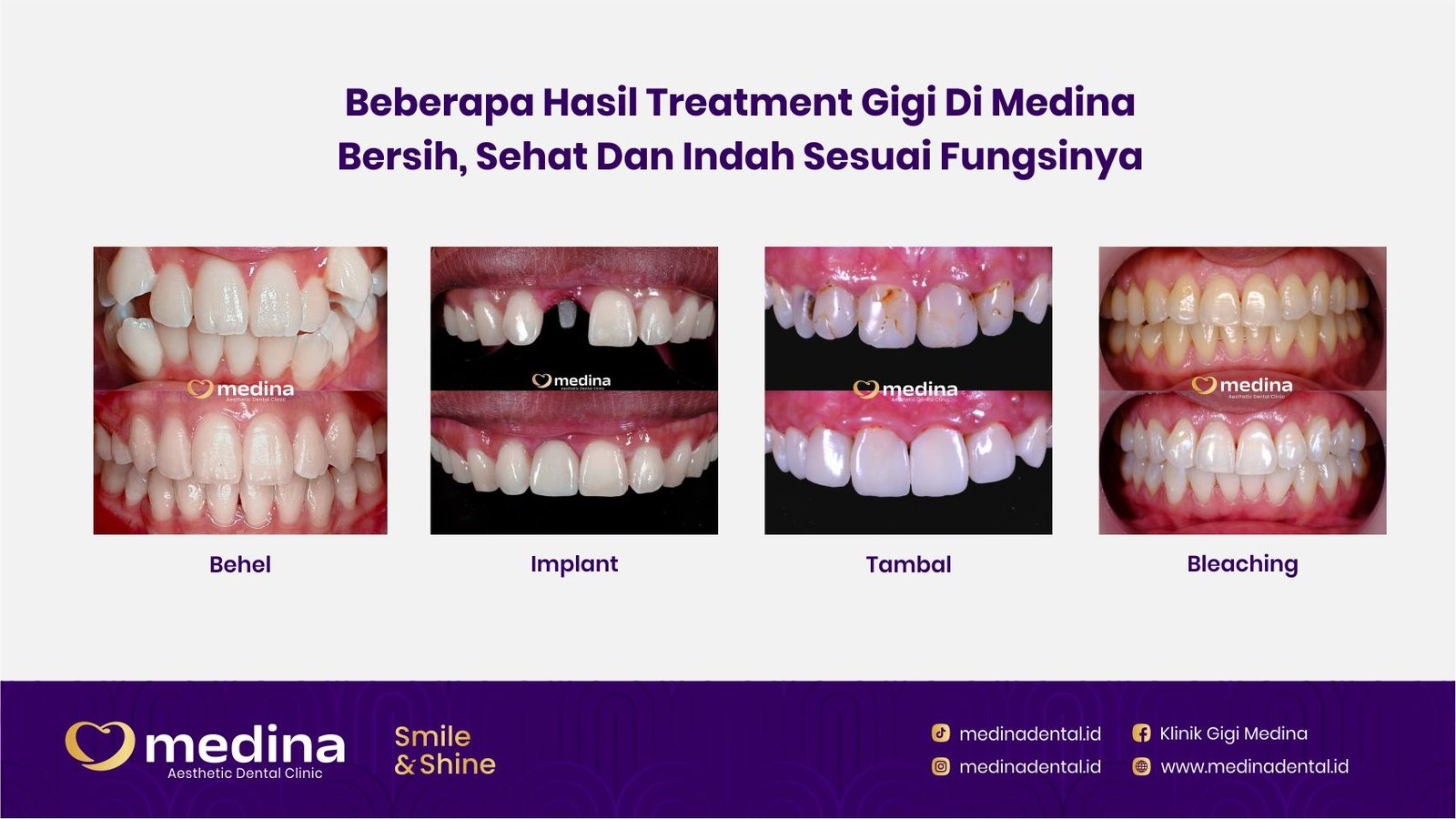 klinik gigi jepara medina