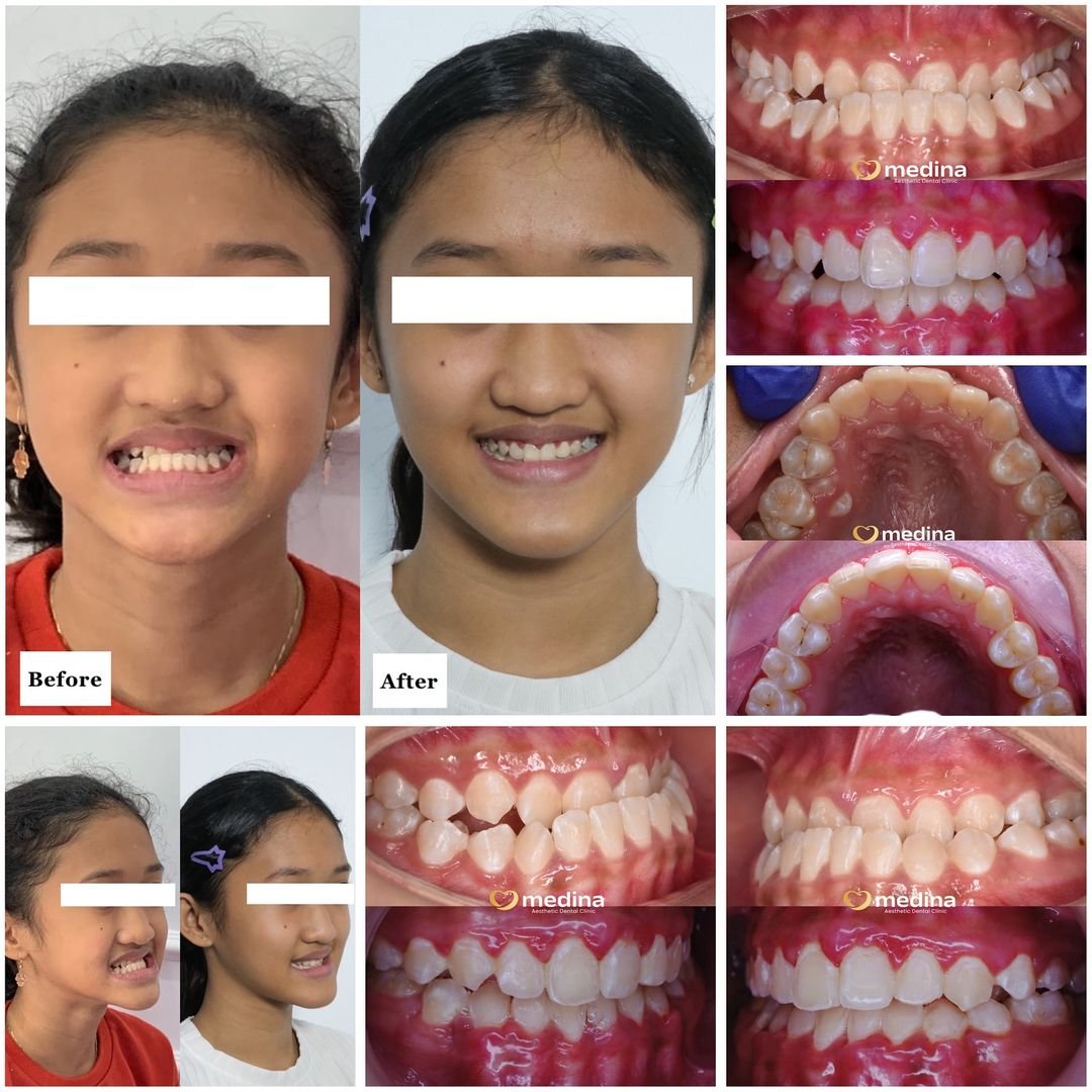 BEHEL DOKTER GIGI JEPARA MEDINA