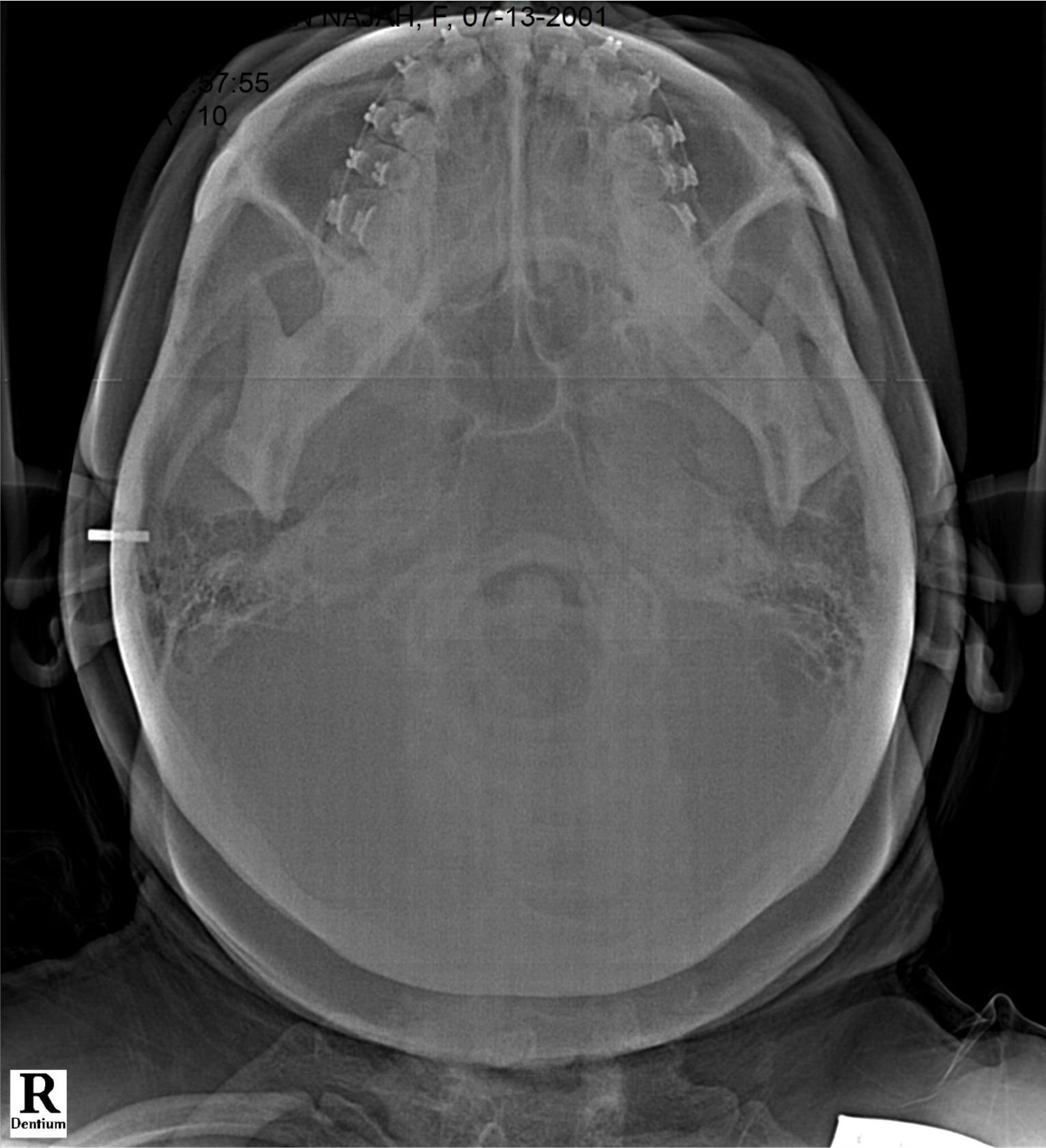 RONTGEN SINUS KLINIK GIGI JEPARA MEDINA
