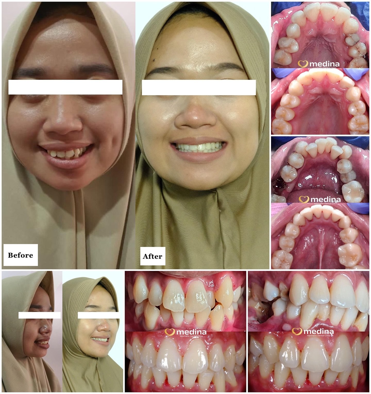 BEHEL GIGI KLINIK GIGI JEPARA MEDINA