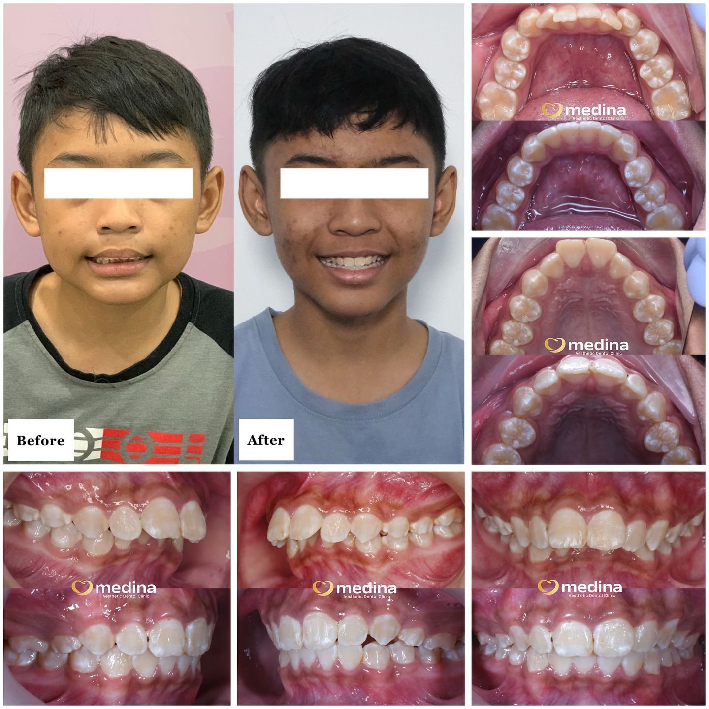 BEHEL GIGI KLINIK GIGI JEPARA MEDINA