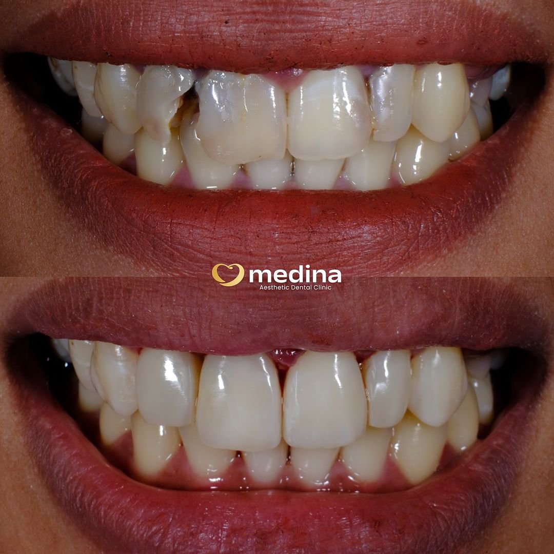 TAMBAL GIGI KLINIK GIGI JEPARA MEDINA