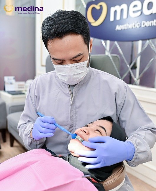 BEHEL GIGI MEDINA JEPARA